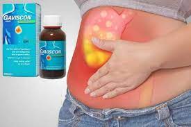 Gaviscon advance sospensione orale aroma menta in bustine. Gaviscon Advance Foglio Illustrativo Dosi Opinioni