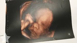Bei der ssw 29 ultraschall untersuchung wird dein baby gründlich durchgecheckt. Schwanger Oder Krank Im 8 Monat Schwanger 3 Kind