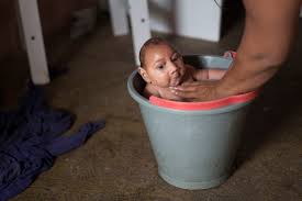 The structure provides clues to understanding how zika virus enters human cells and suggests ways to design drugs or vaccines to combat the virus. The Zika Virus May Cause Birth Defects And Experts Think It S Coming To The Us Vox