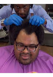 His Hairline has Thin corners and made him want to go BALD😭, do we bl...