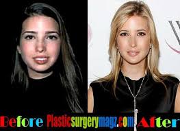 Plastic Surgery Magazine Ivanka Trump Plastic Surgery Before And After Http Plasticsurgerymagz Com Plastic Surgery Celebrity Plastic Surgery Surgery