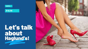 A ridge of bone along the posterior superior lateral ridge of the calcaneus often causing bursal inflammation of the achilles bursa and often associated with calcification or spur of the. Get Rid Of That Unsightly Pump Bump Podiatrist In Richmond Va