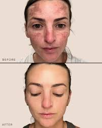 Emily Epley, MSN, FNP-C 💉 (@emilyepley_np) • Instagram photos and videos