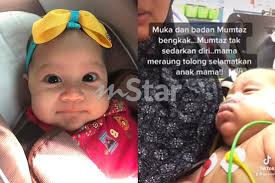 Tidak seperti asi, susu formula tidak memiliki antibodi. Tubuh Merah Merah Selepas 10 Minit Minum Susu Formula Mak Panik Anak Usia 6 Bulan Tiba Tiba Tak Sedarkan Diri Itulah Kali Pertama Dan Terakhir Viral Mstar