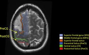 The main functions of the neck muscles are to permit movements of the neck or head and to provide structural support of the head. Functional Brain Anatomy Neuroimaging Clinics