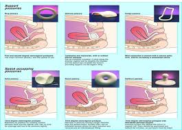 Image result for Pessary