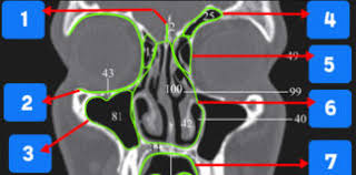 Challenge them to a trivia party! Ct Anatomy Quiz