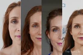 How to apply for pr in malaysia. Vampire Facial Kl Autologous Platelet Rich Plasma The Yum List