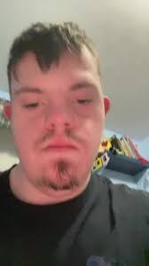 Exploring Shiitake Mushrooms: Benefits and Uses