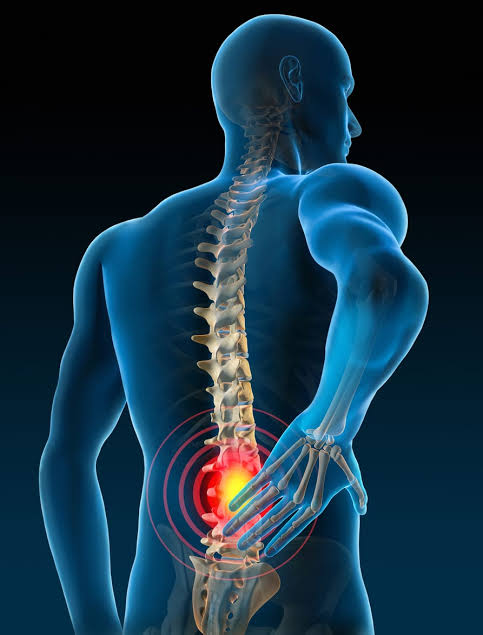 Sciatica pain