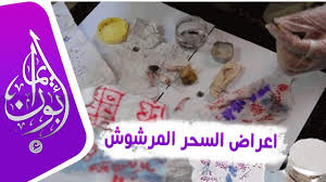 نقص دم الحيض يعد من أحد تلك الأعراض الشائعة الحدوث لدى النساء ، حيث تكون الدورة القصيرة أو أن يكون نسبة تكون الدم الناتجة عنها بسيطة ، و غالباً ، و في الوضع الطبيعي ما يكون استمرار الحيض من يومان إلى ستة أيام أي. ÙØ¹ÙØ¨ Ø®Ø·Ø± Ø±Ø¬Ù Ø¹ØµØ§Ø¨Ø© Ø³Ø­Ø± Ø¨Ø¯Ù Ø§ÙØ­ÙØ¶ ÙÙ Ø§ÙØ¨ÙØ¶ Shivayssc Com
