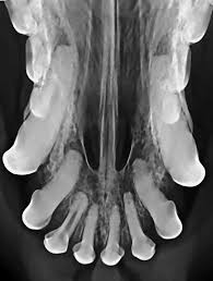 Republika ng pilipinas), is an archipelagic country in southeast asia. Why Your Practice Needs Dental Radiography