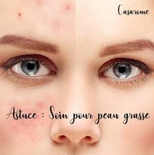 Astuce Au Naturel Soin Pour Peau Grasse Tout Les Soirs Apres Demaquillage Et Lavage Du Visage Frotter Sur Visage Humide La Makeup Remover Oily Skin Skin