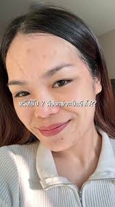 ป้ายยาเซรั่ม Doctor Tony เสริมผิวแกร่งอัพความใส @Dr.Tony หมอโทนี่  #เซรั่มหมอโทนี่ #DRTONY #DoctorTonyShop #คู่จิ้นกระจ่างใส #Geminifourth