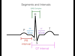 Ekg Ecg Interpretation Basic Easy And Simple Teknik Mekatronika