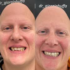 Dr Giorgia Buffa-ortodonzia