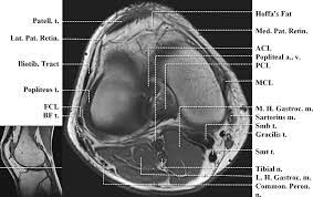 Click on the links to show each structure. Http Www Smartview Co Wp Content Uploads 2014 02 Imagen Mr Normal Anatomia Rodilla Pdf