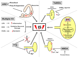 Image result for Infantile Spasms