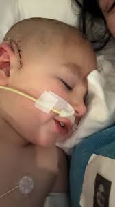 Prayers for successful baby surgery