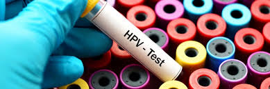 Test Hpv Dove Puoi Farlo E Perche E Uno Screening Importante