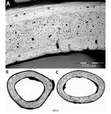 There are trabeculae in spongy bone. Light Microscopy Images Of Cross Sections Of Rat Cortical Bone A Two Download Scientific Diagram