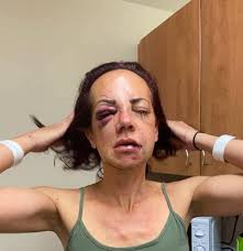 Yate domestic abuser fractured victim's eye and posted naked video