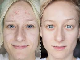 What makeup routine is suitable for super dry skin?