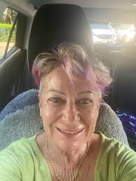 Looking for a DP surgeon in Canada. Any recommendations?