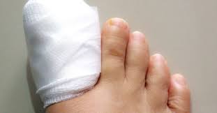 In some cases, an infected toe may be caused by an ingrown nail. Surgery For Ingrown Toenails Procedure Recovery And Risks