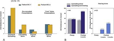 The entire cochlea is about the size of a pea. The Multi Channel Cochlear Implant Multi Disciplinary Development Of Electrical Stimulation Of The Cochlea And The Resulting Clinical Benefit Sciencedirect