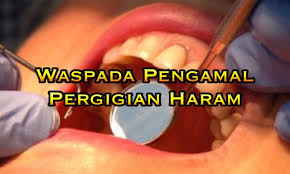 Film action terbaru 38.670 views7 months ago. Kenyataan Akhbar Kpk 7 September 2016 Perkhidmatan Pemasangan Pendakap Gigi Braces Oleh Pengamal Pergigian Haram From The Desk Of The Director General Of Health Malaysia