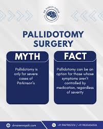 Image result for Pallidotomy