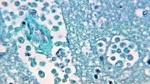 Brain Eating Amoeba Found In South Bossier Parish Water System