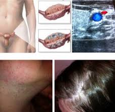 Pcos symptoms may vary from person to person. Pco Syndrom Facharzt Spezialist Bochum Ruhrgebiet Nrw