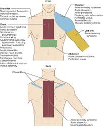 Image result for Chest Pain