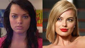 We did not find results for: Margot Robbie Plastic Surgery Transformation Before And After Photos Celebrity Plastic Surgery Plastic Surgery Cosmetic Surgery