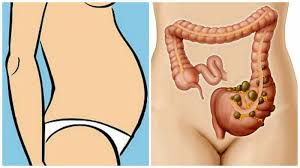 If you're still feeling bloated after making these lifestyle changes, it could be a sign of something deeper. Bloated Stomach Here S How To Get Rid Of It In Just 24 Hours