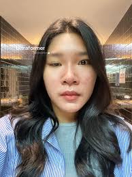 20 ไอเดียยอดนิยมเกี่ยวกับ Mynte Tylte ในปี 2024