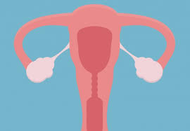 Watch our recorded webinar, ovarian cancer 101, to learn about the common signs and symptoms of ovarian cancer, and the most advanced treatments, so you can take. Simple Rules Calculate Ovarian Cancer Risk Imperial News Imperial College London