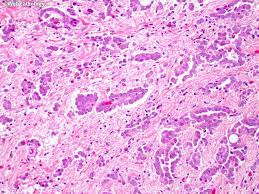 We did not find results for: Webpathology Com A Collection Of Surgical Pathology Images