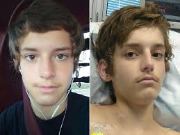 Hunter Brady Diagnosed with The Flu Then Told He Has Cancer