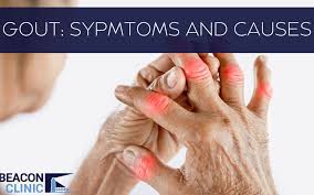 Image result for gout