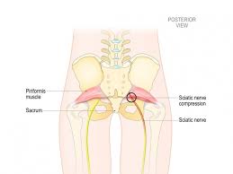 Lower back and buttocks muscle. Sciatica And Sciatic Nerve Pain Information