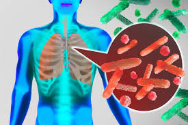 How Suppressing The Immune System Can Save Lives In Severe Covid 19 Cases