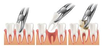 Customer service award winners 2019. Tooth Extraction Auckland Greenlane Dental Services