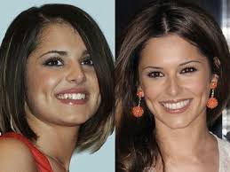 No matter the age, celebrities have been spotted wearing braces. Celebrity Teeth Makeover Docklands Dental