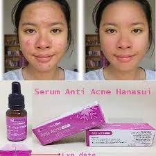 0 reviews write a review. Jual Vitamine E Pemutih Terbaru Lazada Co Id