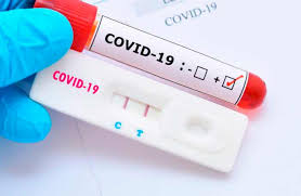 Și nu în ultimul rând, anunțăm pe această cale că societatea medimfarm a hotărât să. Testes Rapidos Feitos Nas Farmacias Tem Resultados Positivo Para Covid 19 Em 15 Dos Casos