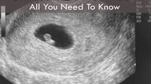 Maybe you would like to learn more about one of these? 6 Week Ultrasound All You Need To Know As A New Mom