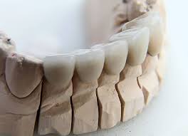 And an exam by a dentist can be $50. Dental Crown Cost How Much Is A Tooth Crown Porcelain 2021